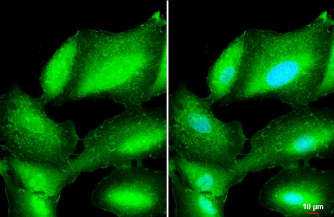 L-Plastin Antibody in Immunocytochemistry (ICC/IF)