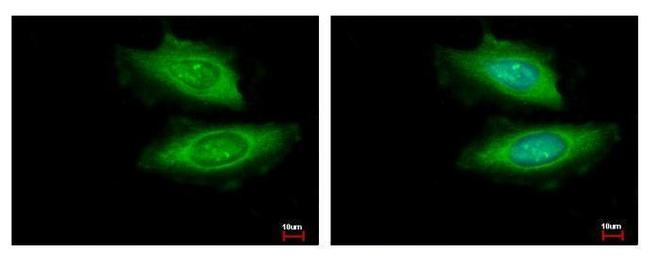 VCPIP1 Antibody in Immunocytochemistry (ICC/IF)