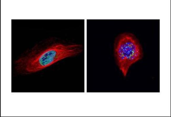 Bub1 Antibody in Immunocytochemistry (ICC/IF)