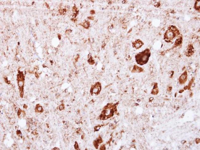 GRK2 Antibody in Immunohistochemistry (Paraffin) (IHC (P))