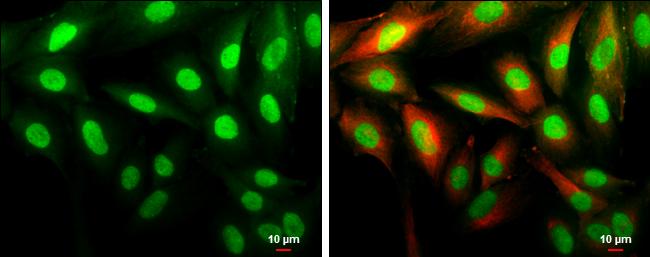 Cyclin D1 Antibody in Immunocytochemistry (ICC/IF)