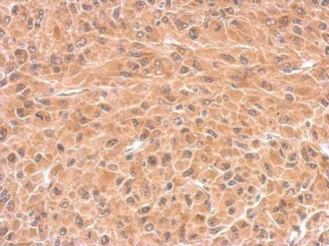 DCTD Antibody in Immunohistochemistry (Paraffin) (IHC (P))