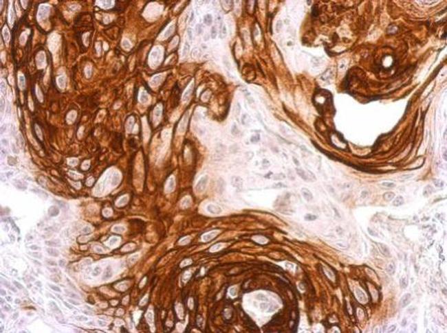 ACVR1 Antibody in Immunohistochemistry (Paraffin) (IHC (P))