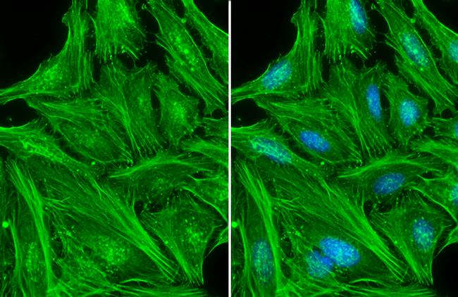 beta Actin Antibody in Immunocytochemistry (ICC/IF)