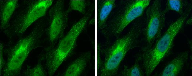 Bax Antibody in Immunocytochemistry (ICC/IF)