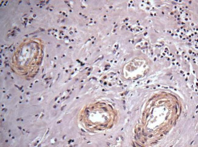 Vinculin Antibody in Immunohistochemistry (Paraffin) (IHC (P))