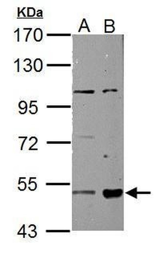 ALDH3A2 Antibody in Western Blot (WB)