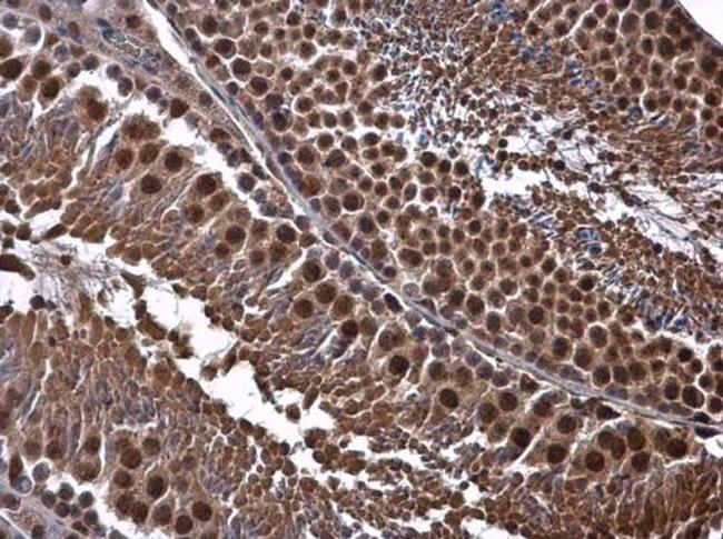 CDK8 Antibody in Immunohistochemistry (Paraffin) (IHC (P))