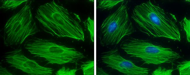 beta Actin Antibody in Immunocytochemistry (ICC/IF)