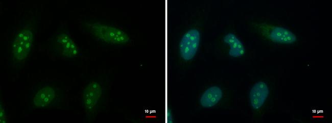 GTPBP4 Antibody in Immunocytochemistry (ICC/IF)