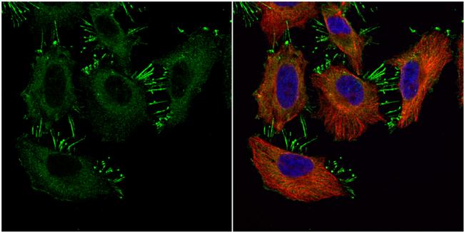 Catenin alpha-1 Antibody in Immunocytochemistry (ICC/IF)