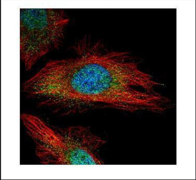 Phospho-TYK2 (Tyr1054, Tyr1055) Antibody in Immunocytochemistry (ICC/IF)