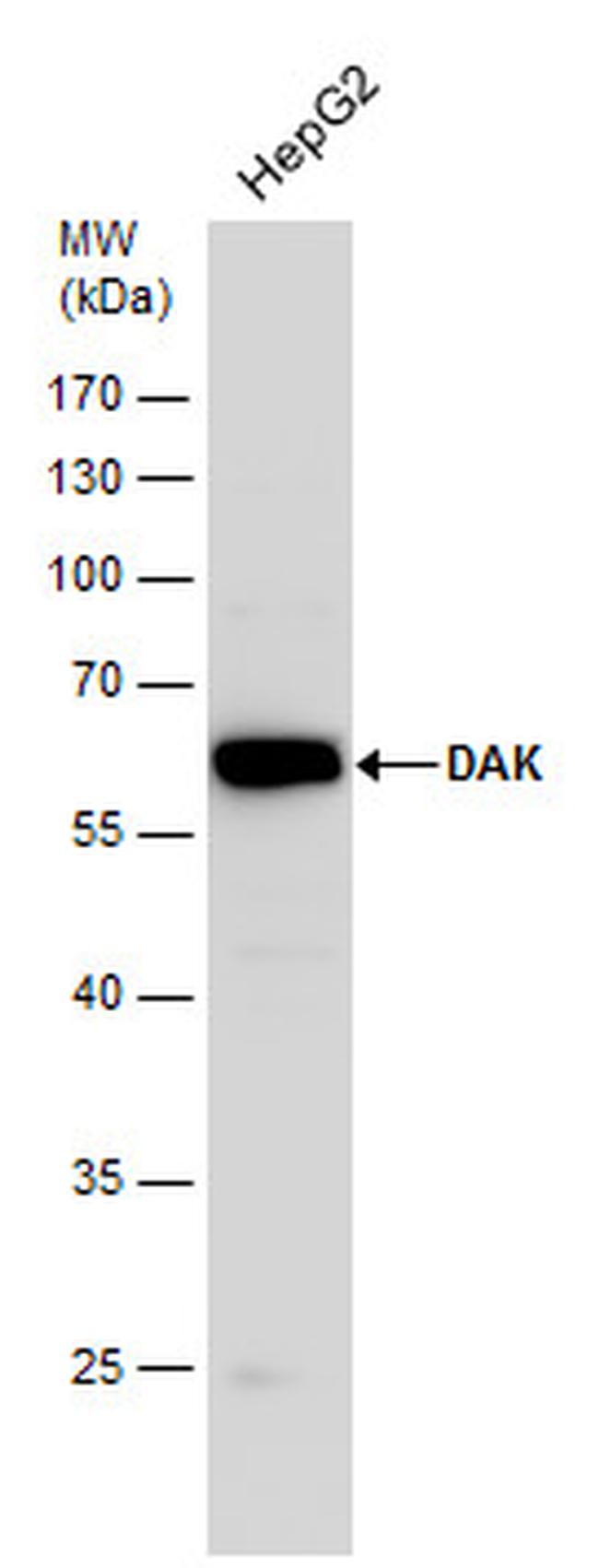 DAK Antibody in Western Blot (WB)