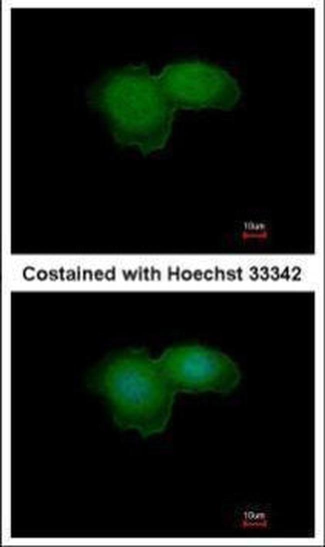 BTK Antibody in Immunocytochemistry (ICC/IF)