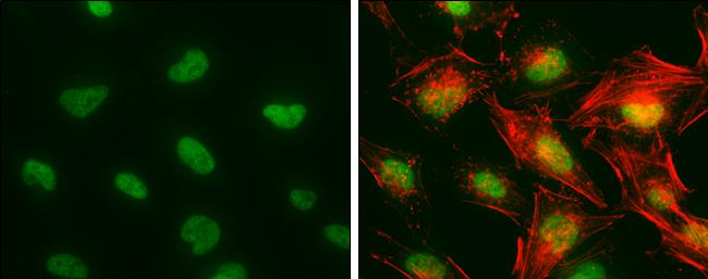 CA150 Antibody in Immunocytochemistry (ICC/IF)