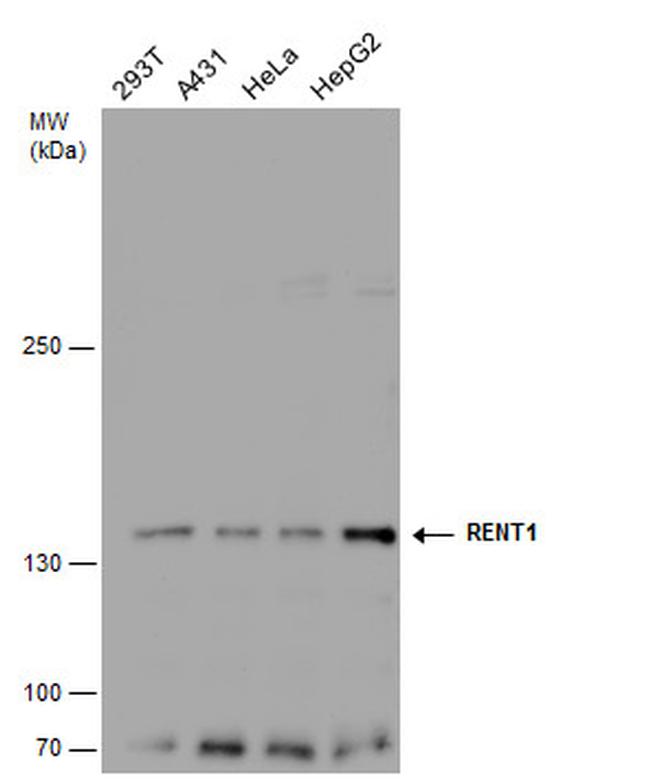 UPF1 Antibody in Western Blot (WB)