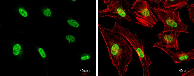 NPM1 Antibody in Immunocytochemistry (ICC/IF)