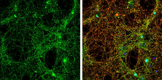 alpha Synuclein Antibody in Immunocytochemistry (ICC/IF)