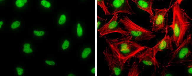 CREB Antibody in Immunocytochemistry (ICC/IF)