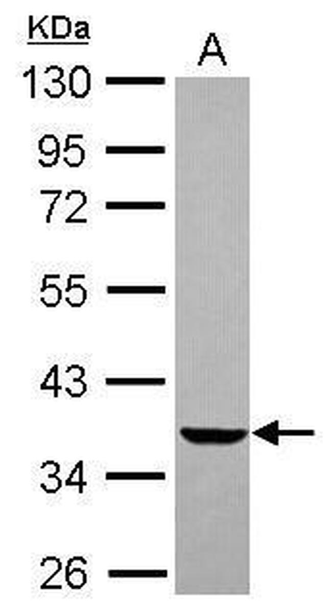 EDG2 Antibody in Western Blot (WB)