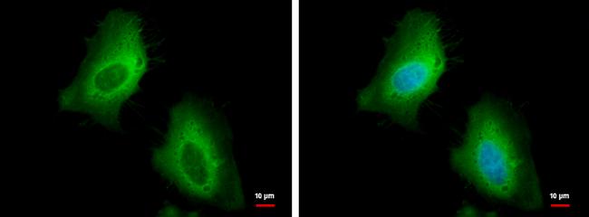 HSP27 Antibody in Immunocytochemistry (ICC/IF)