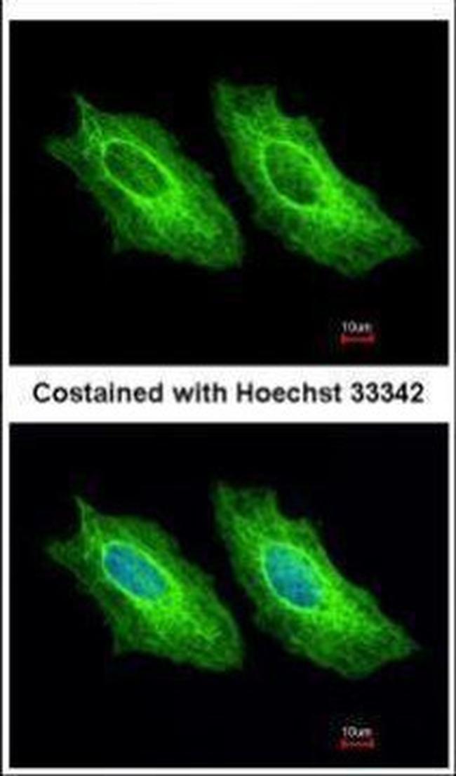 Cytokeratin 18 Antibody in Immunocytochemistry (ICC/IF)