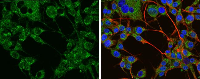 Tyrosine Hydroxylase Antibody in Immunocytochemistry (ICC/IF)