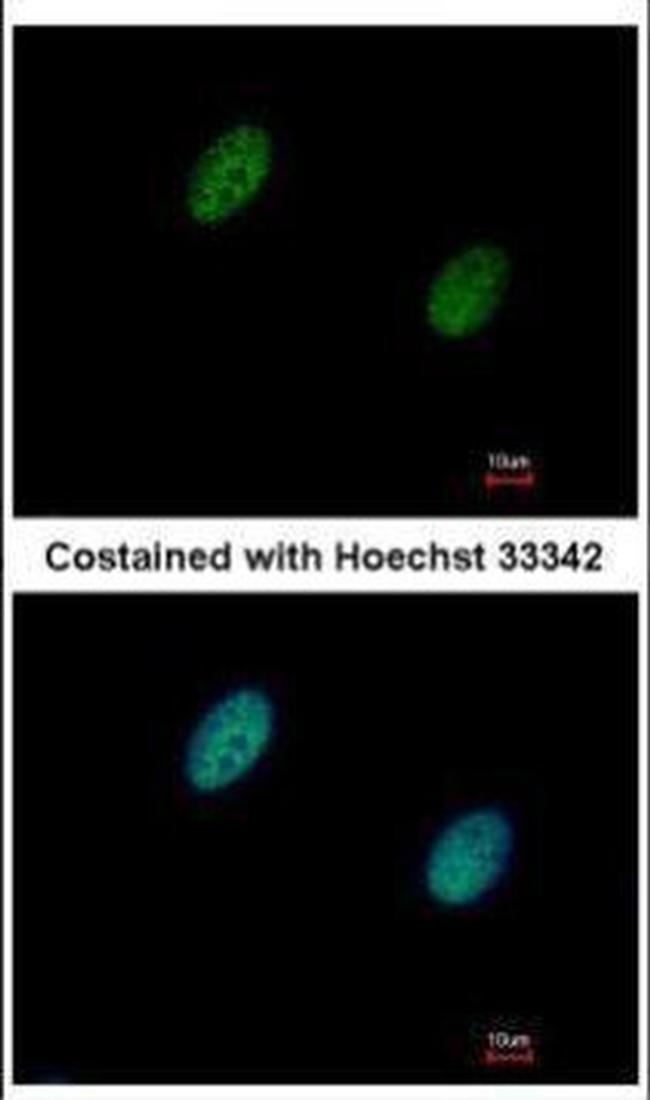 CHK2 Antibody in Immunocytochemistry (ICC/IF)