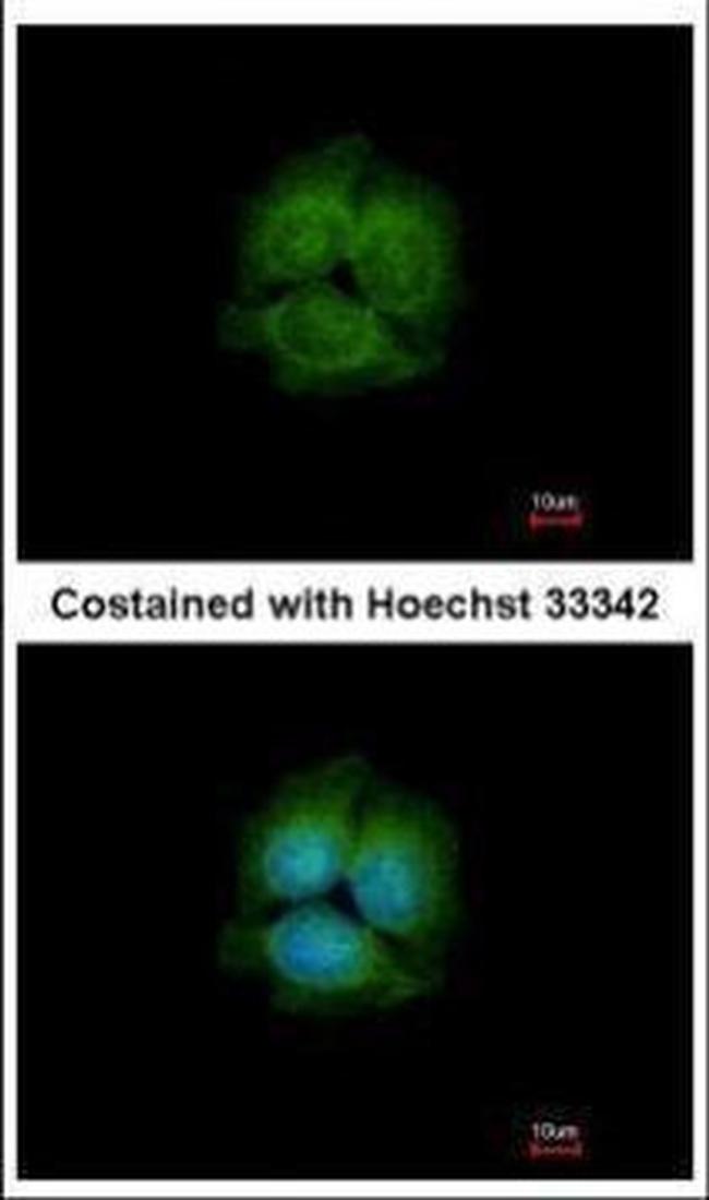 LRRK2 Antibody in Immunocytochemistry (ICC/IF)