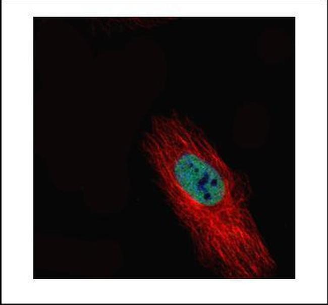 HDAC2 Antibody in Immunocytochemistry (ICC/IF)