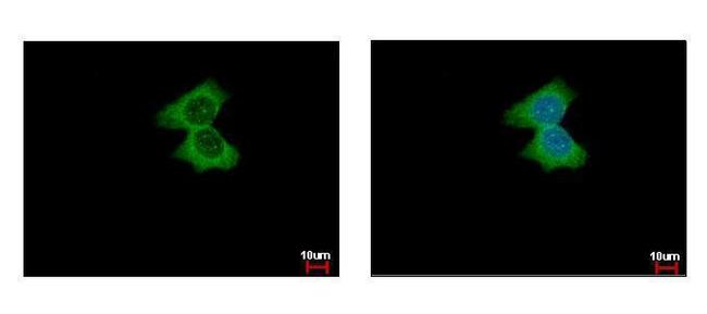 alpha Actinin 4 Antibody in Immunocytochemistry (ICC/IF)