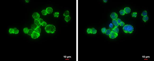 CD11a Antibody in Immunocytochemistry (ICC/IF)