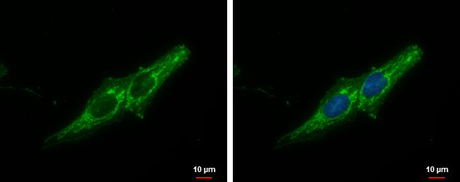 Prohibitin Antibody in Immunocytochemistry (ICC/IF)