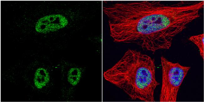 HDAC3 Antibody in Immunocytochemistry (ICC/IF)