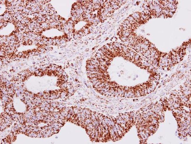 ERAB Antibody in Immunohistochemistry (Paraffin) (IHC (P))