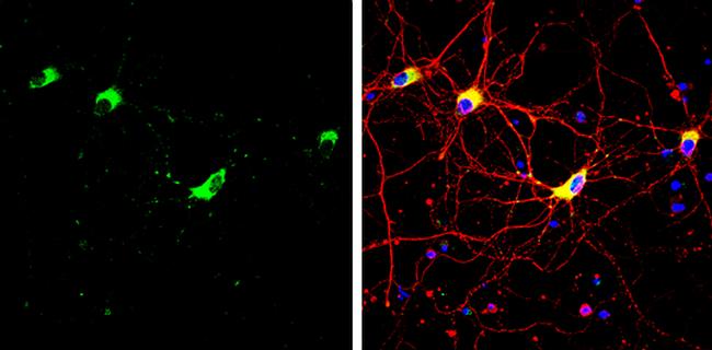 STIM1 Antibody in Immunocytochemistry (ICC/IF)