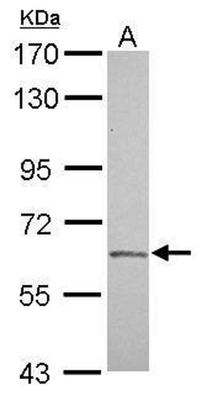 Factor XI Antibody in Western Blot (WB)