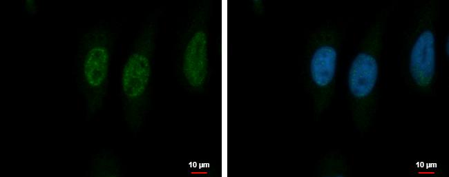 PSMA5 Antibody in Immunocytochemistry (ICC/IF)