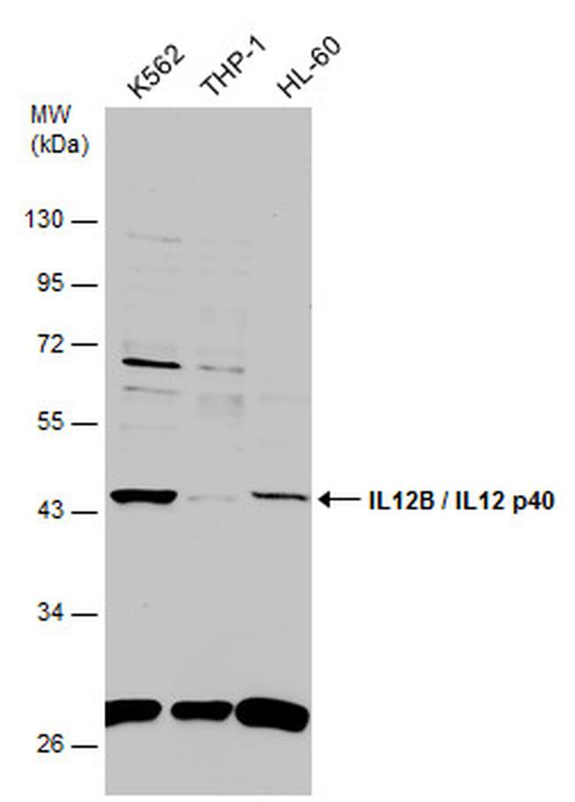 IL-12/IL-23 p40 Antibody in Western Blot (WB)