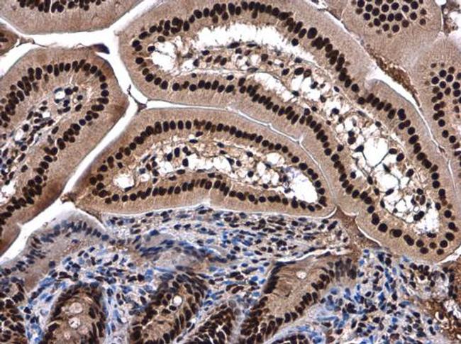 SMARCC2 Antibody in Immunohistochemistry (Paraffin) (IHC (P))