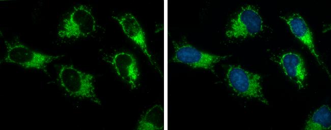 ACAA2 Antibody in Immunocytochemistry (ICC/IF)