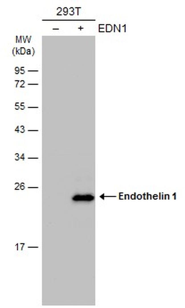 Endothelin 1 Antibody in Western Blot (WB)