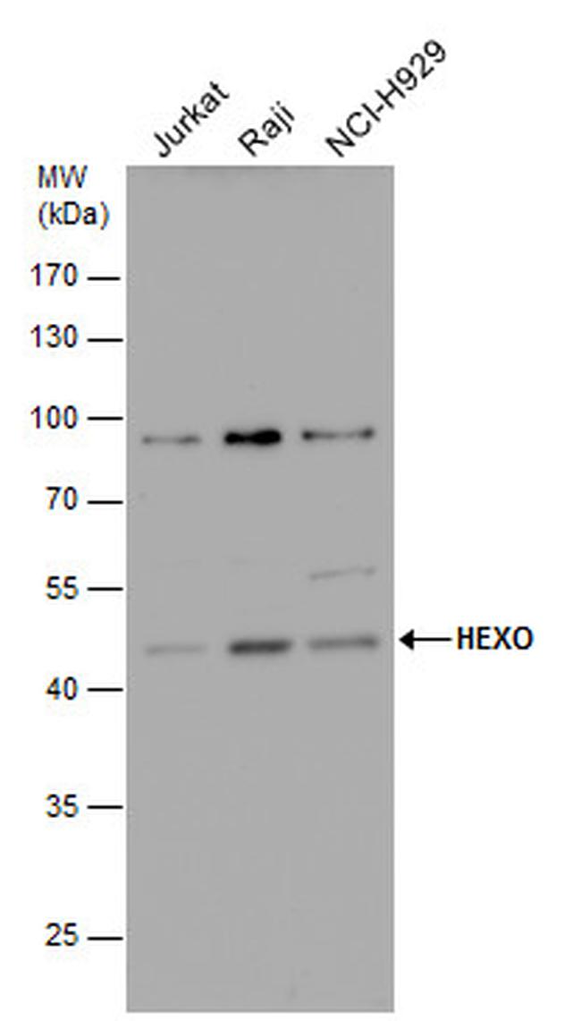 ERI1 Antibody in Western Blot (WB)