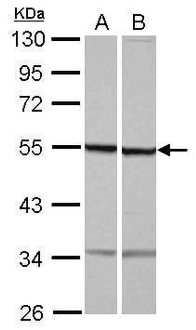 beta Tubulin Antibody in Western Blot (WB)