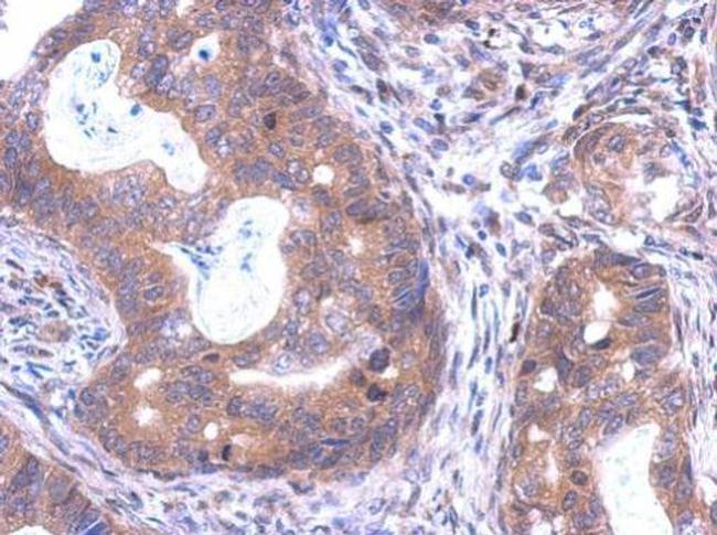 SKA1 Antibody in Immunohistochemistry (Paraffin) (IHC (P))