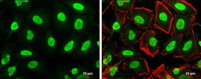 Histone H3 Antibody in Immunocytochemistry (ICC/IF)