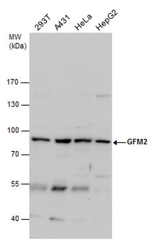 GFM2 Antibody in Western Blot (WB)