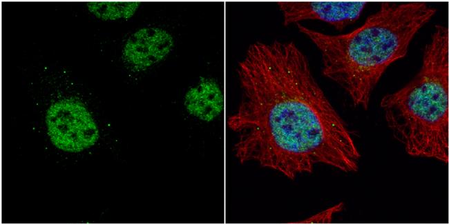 TET2 Antibody in Immunocytochemistry (ICC/IF)