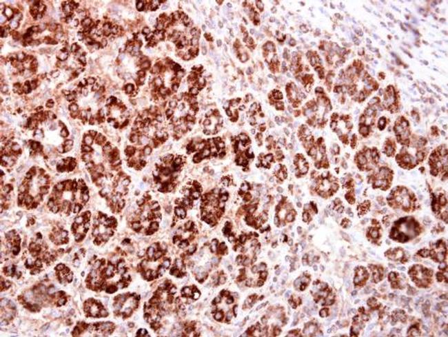 HMGCS2 Antibody in Immunohistochemistry (Paraffin) (IHC (P))