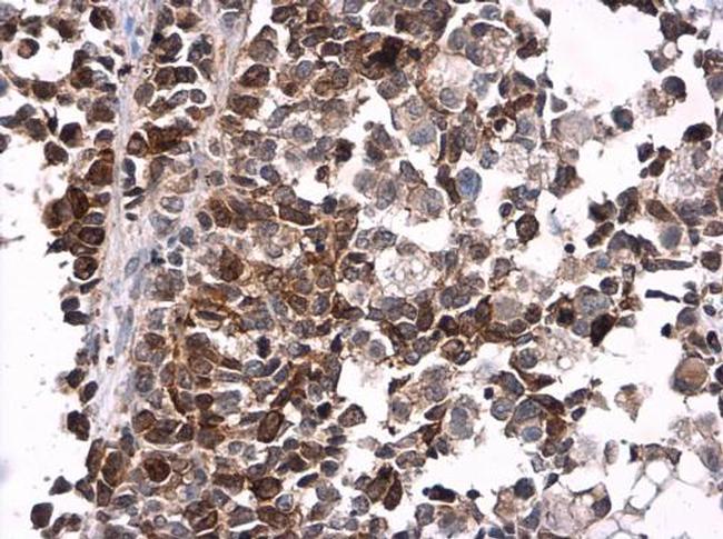 Phospho-CDK1 (Tyr15) Antibody in Immunohistochemistry (Paraffin) (IHC (P))